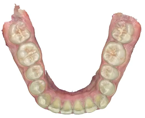 Case 7, after treatment