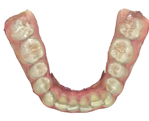 Case 7, before treatment