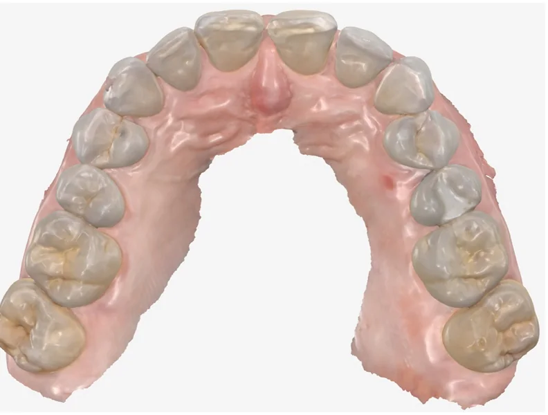 Case 9, after treatment