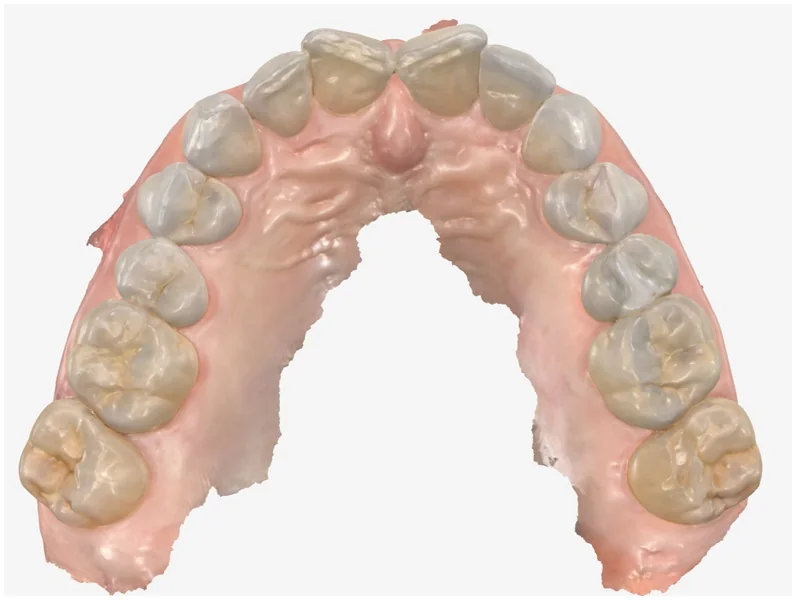 Case 9, before treatment