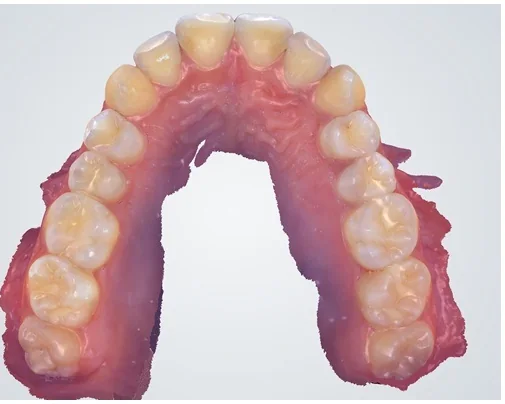 Case 3, after treatment