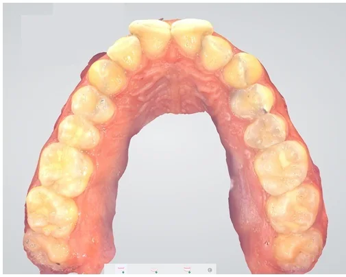 Case 3, before treatment