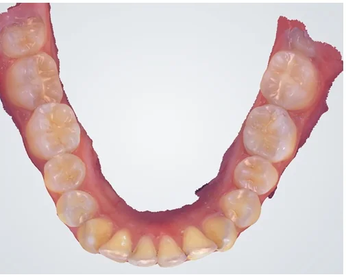 Case 5, after treatment