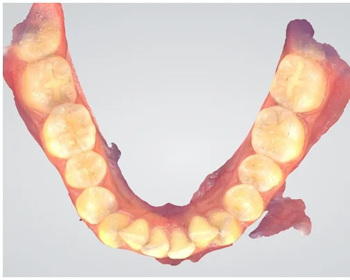 Case 5, before treatment