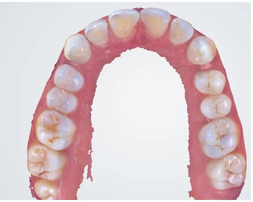 Case 2, after treatment