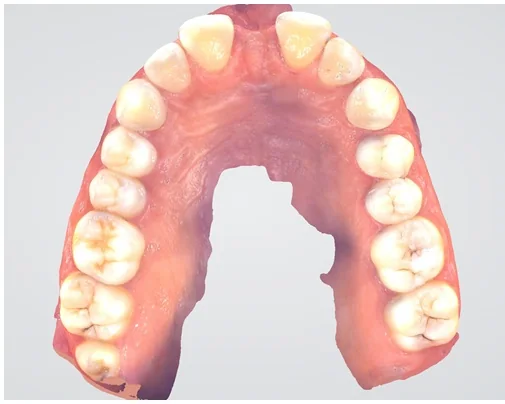 Case 2, before treatment