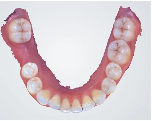 Case 4, after treatment