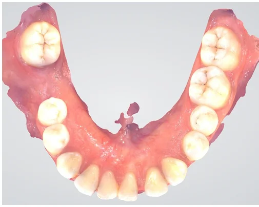 Case 4, before treatment