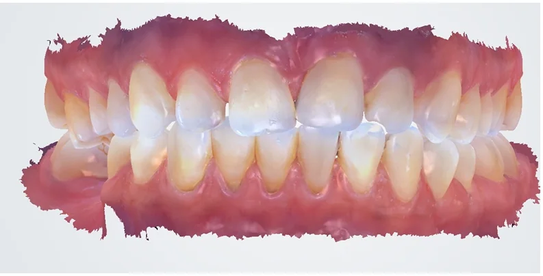 Case 1, after treatment