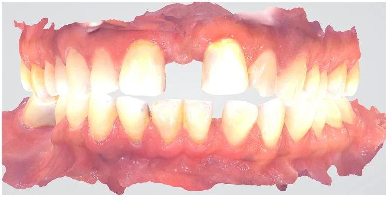 Case 1, before treatment