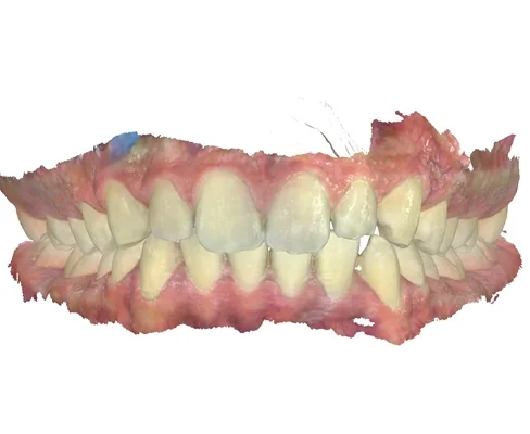 Case 10, after treatment