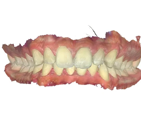 Case 10, before treatment