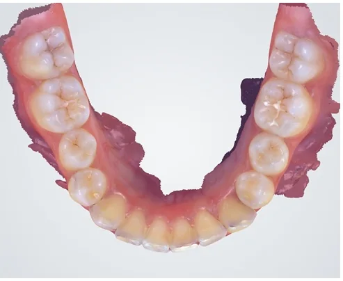 Case 6, after treatment