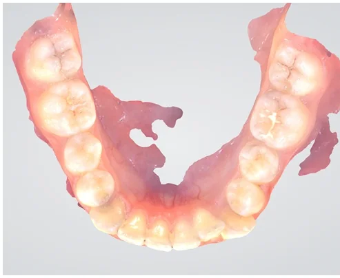 Case 6, before treatment