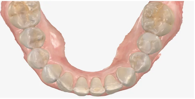 Case 8, after treatment