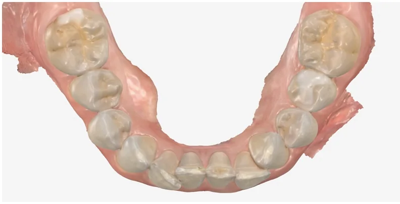 Case 8, before treatment